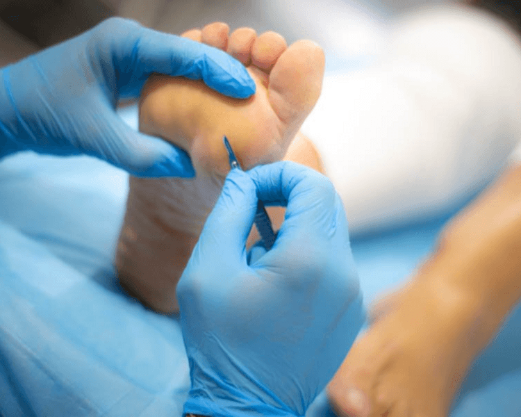 Podología Clínica Avanzada con esmaltado