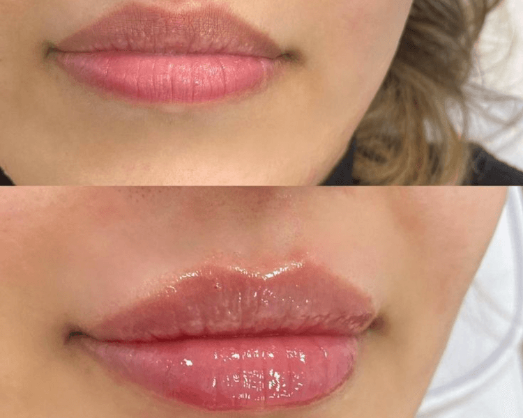 glow lips labios (color + hidratación )