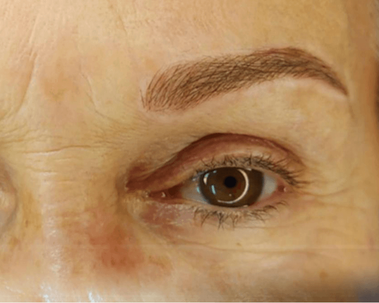 Microblanding pelo a pelo