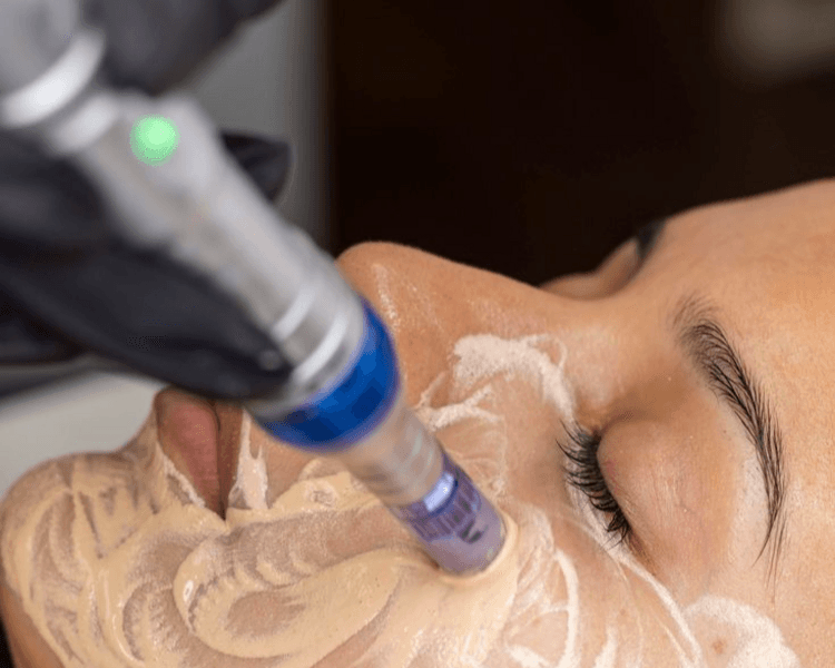Limpieza Facial Basica