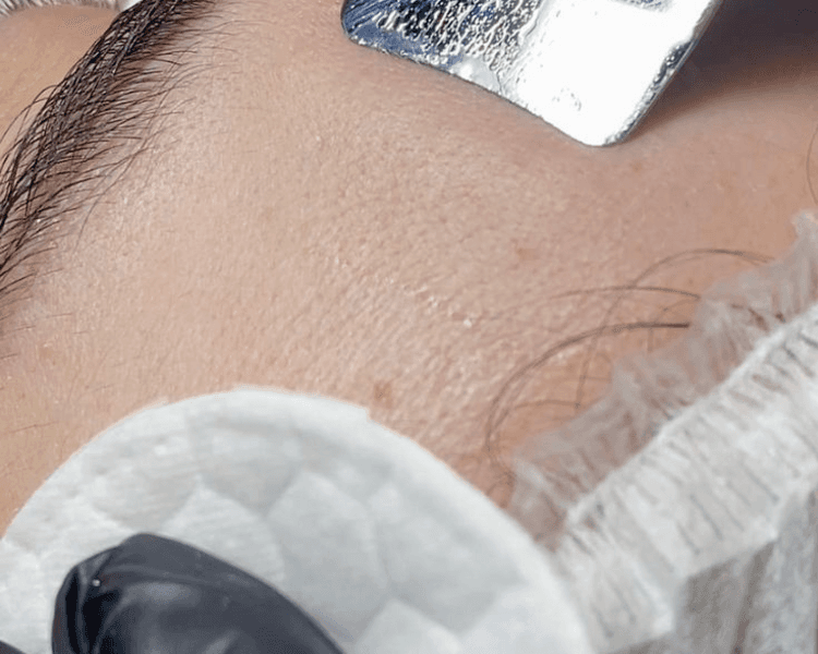 Limpieza Facial con Dermaplaning