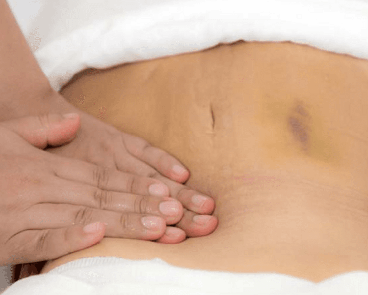 drenaje post-operatorio 1 sesión