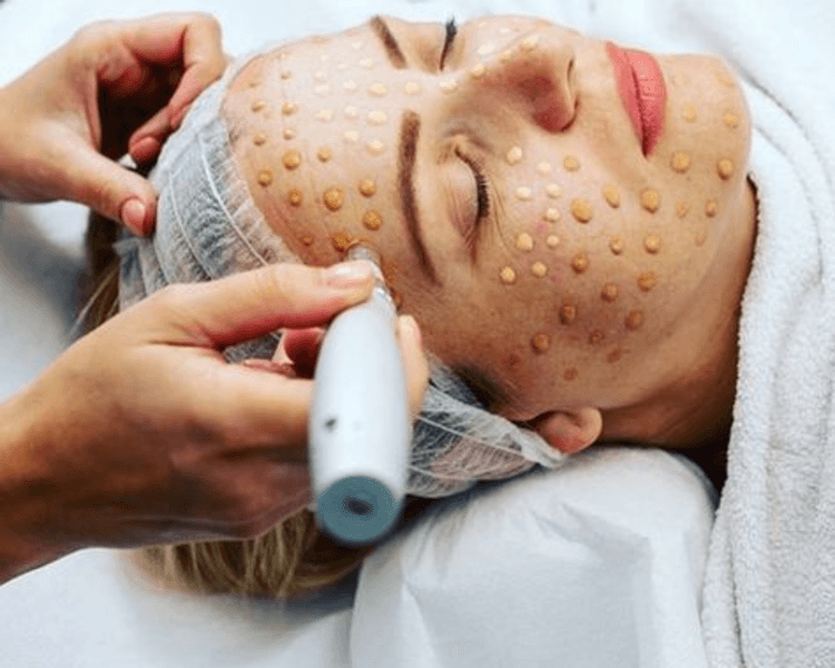 BBGlow PAQUETE 3 SESIONES