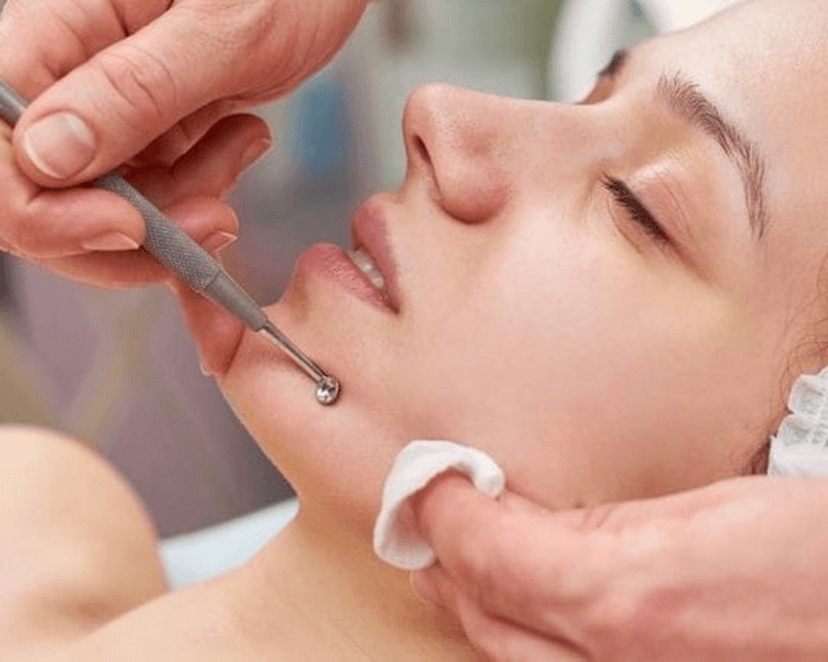 Detox con extracciones