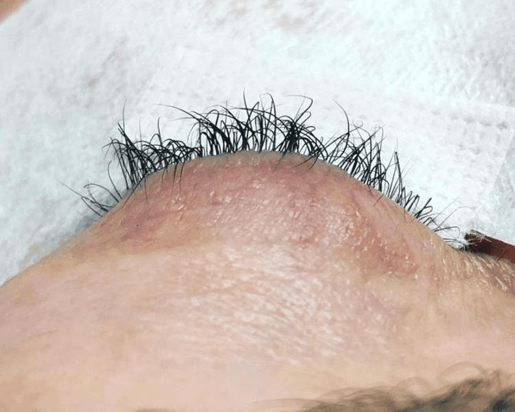 Reversa de Lifting de Pestañas