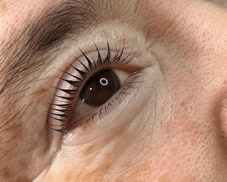 Lifting con tinte y botox