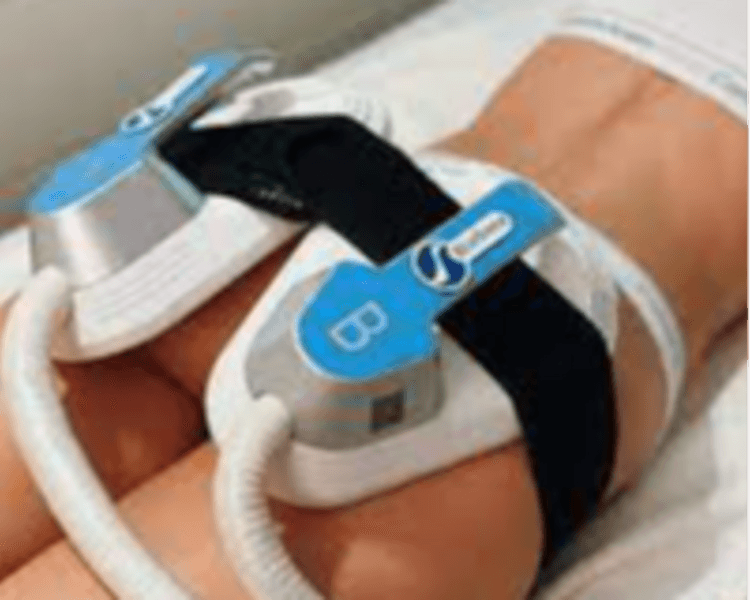 Quad (Mio Up) x 3 zonas