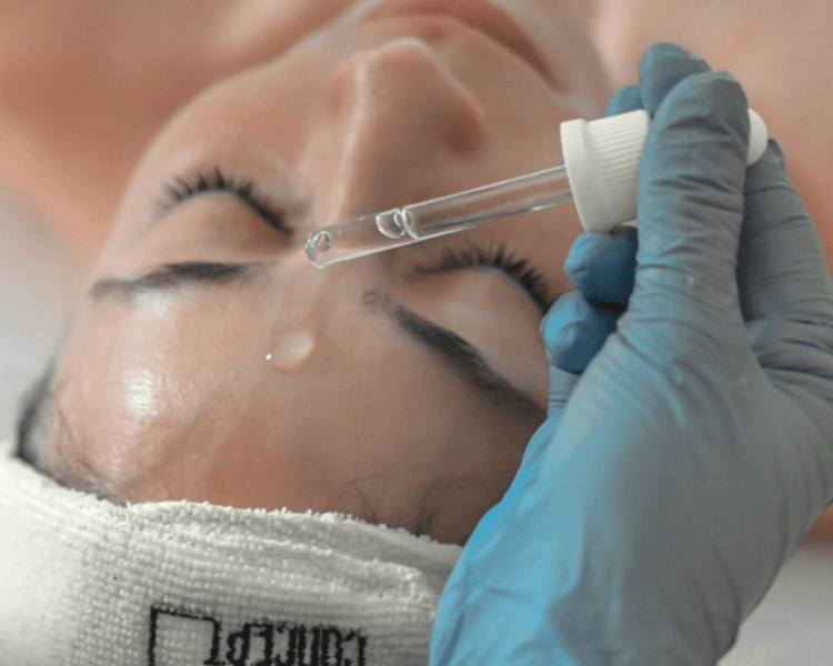 Peeling quimico + Electroporador