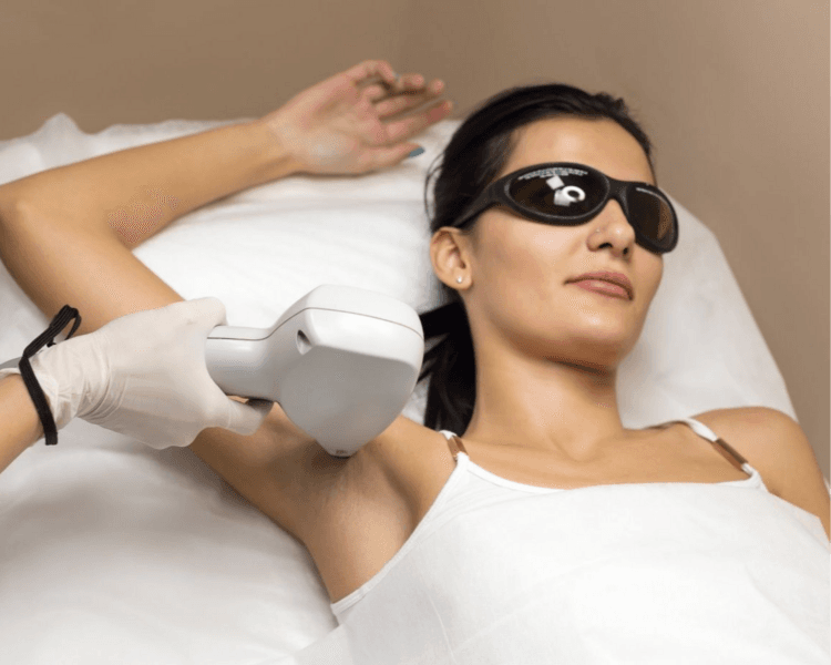 Depilación Axila ( 5 secciones)