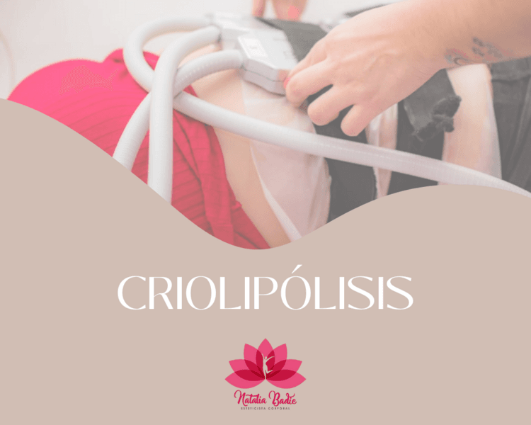 Criolipolisis por zona