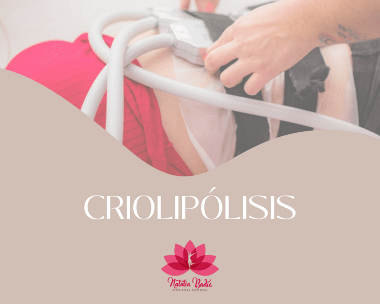 Criolipolisis promo gluteos y piernas