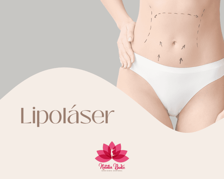 Lipolaser x 8 sesiones