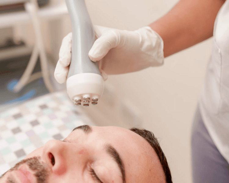 RADIOFRECUENCIA BIPOLAR FACIAL