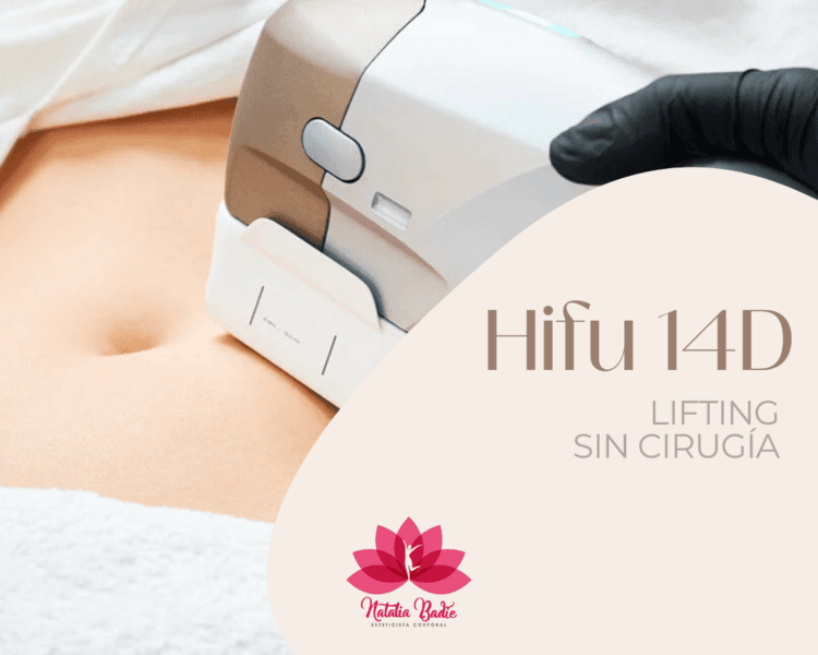 Promo Hifu 14D Abdomen, flancos y contorno de corpiño