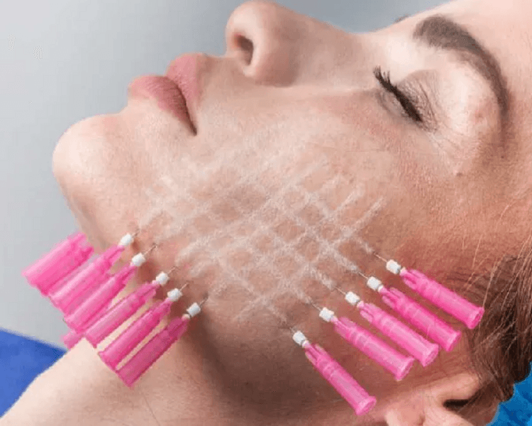 40 HILOS REVITALIZANTES ROSTRO