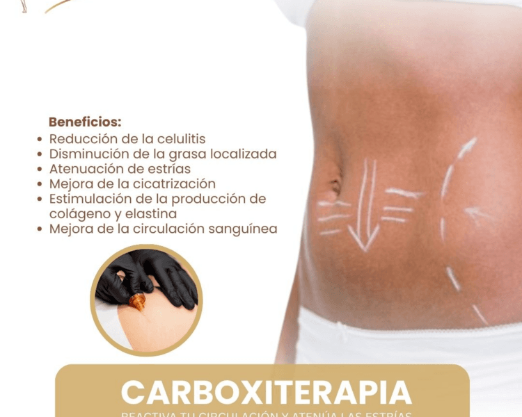 CARBOXITERAPIA PACK 10 SESIONES