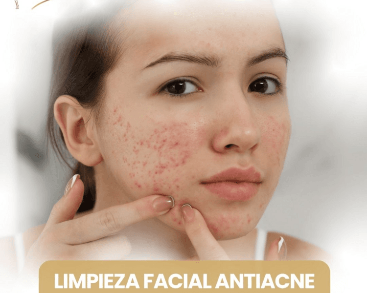 LIMPIEZA FACIAL ACTIACNE