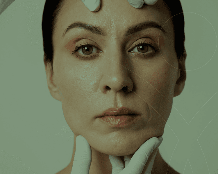 Bioestimuladores ácido polilactico