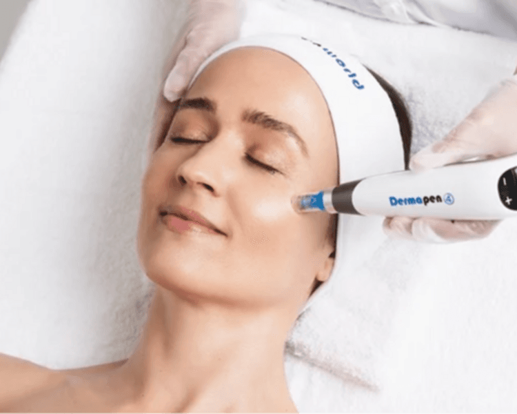 DERMAPEN O MICRONEEDLING