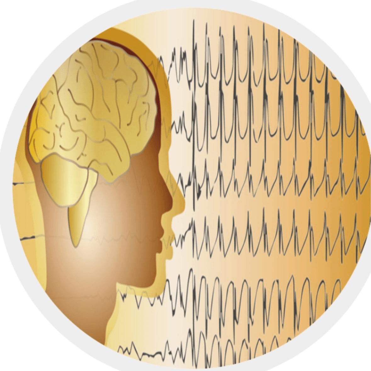 ELECTROENCEFALOGRAMA photo