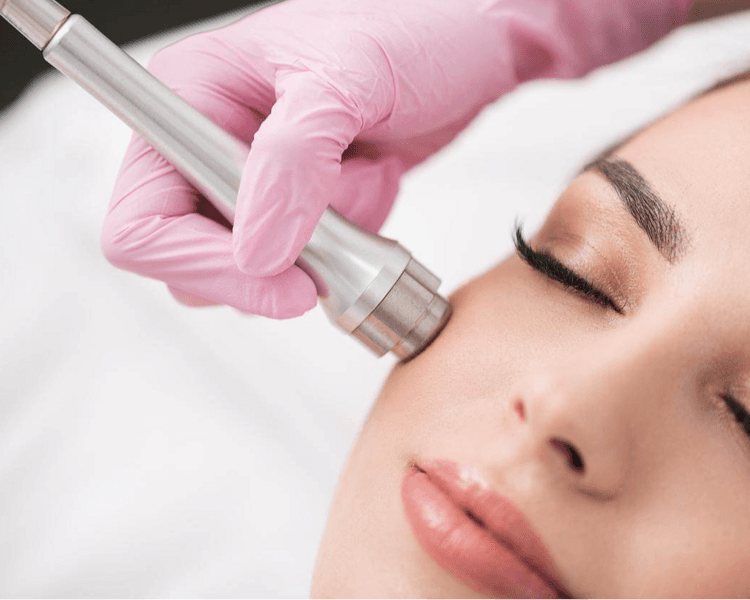 Microdermoabrasión 2.0