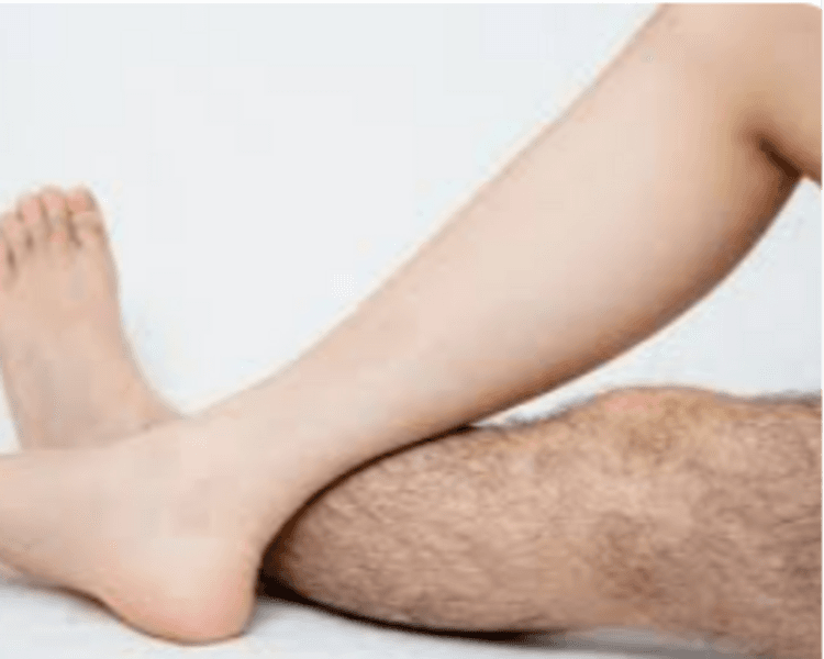 Depilación Láser Piernas Completas) Hombre