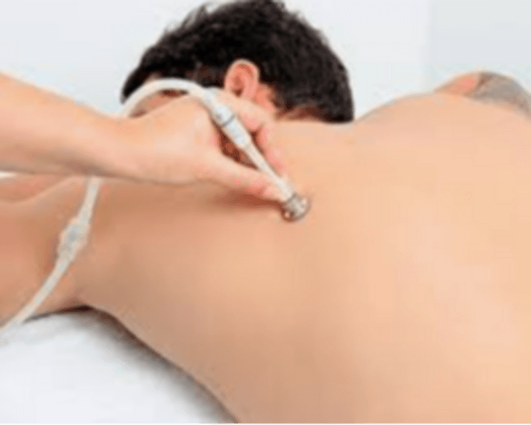 Limpieza profunda de espalda con microdermoabrasión (punta de diamante)