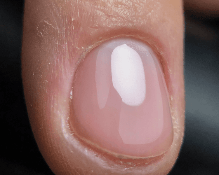 kapping NIVELADOR LISO