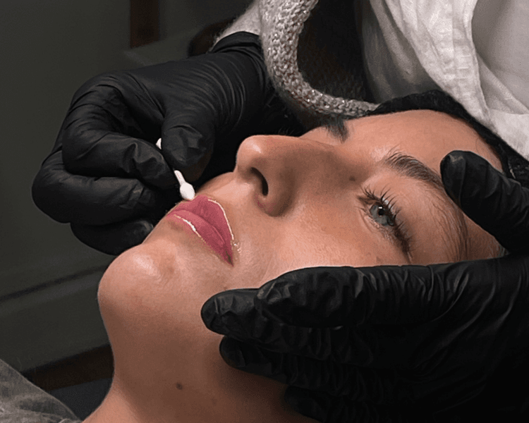 3 Sesiones de HIDRA LIPS GLOSS