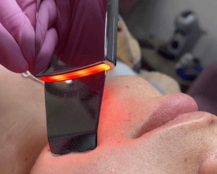 2 Limpiezas profundas