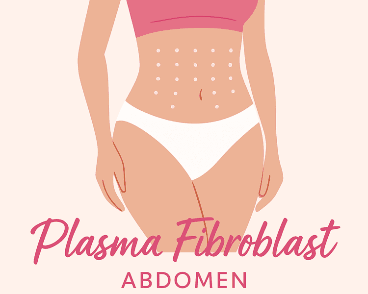 Plasma fibroblast abdomen para flacidez (guatita delantal)