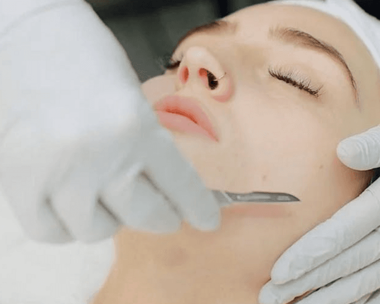 Dermaplaning + Peeling Decapage rostro