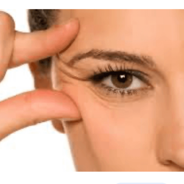 VS54 BOTOX 100U Allergan