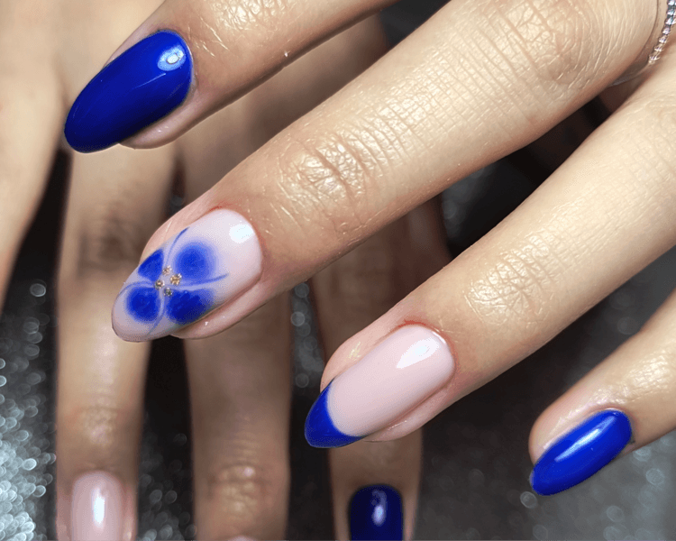 Nivelación semipermanente (capping)