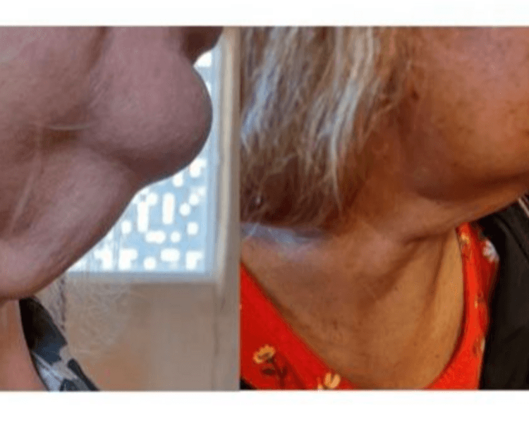 LIPOPAPADA ENZYMAS EZYREE