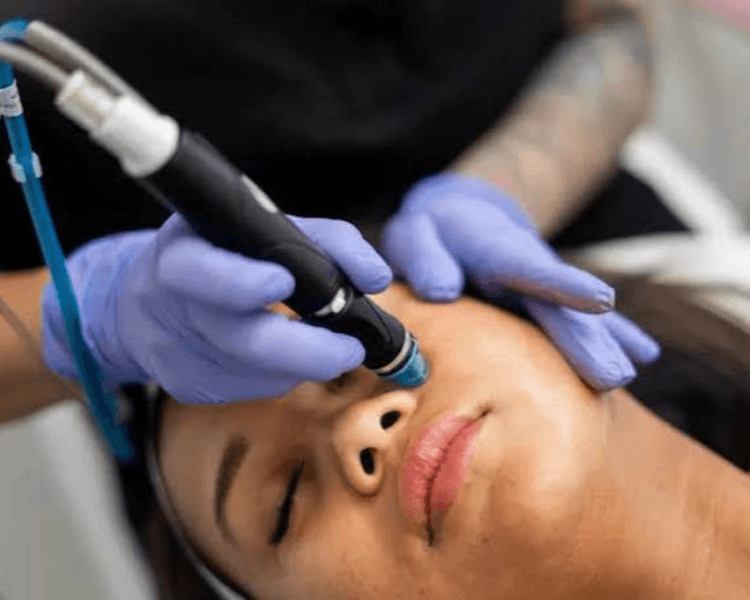 HYDRAFACIAL