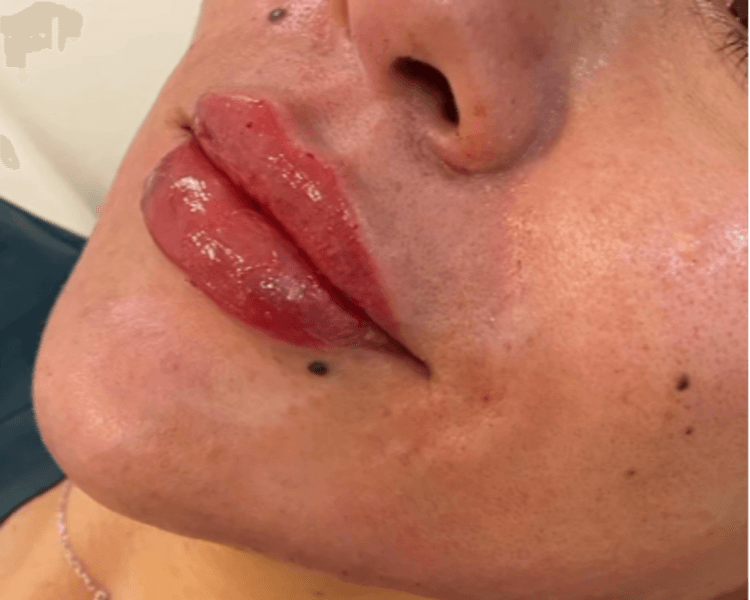 Arabian Face Acido Hialuronico