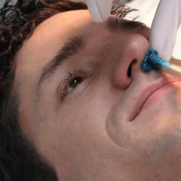 Depilación Facial (Orejas - Nariz)