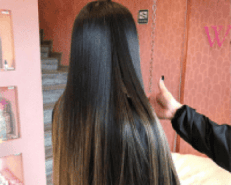 Cirugía Capilar Clásica ¡Nuestro TOP Seller desde 2016!