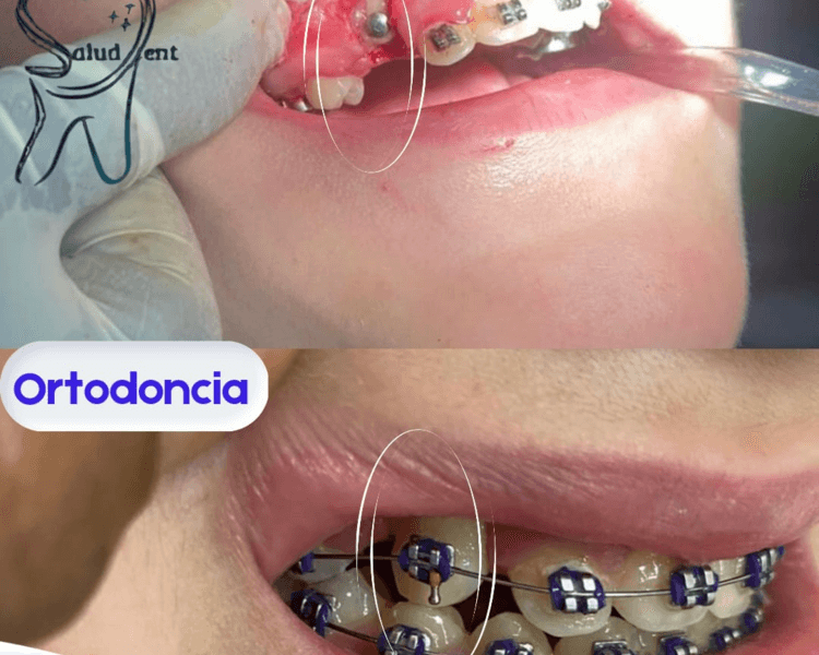 Evaluacion Ortodoncia /Adulto e Infantil