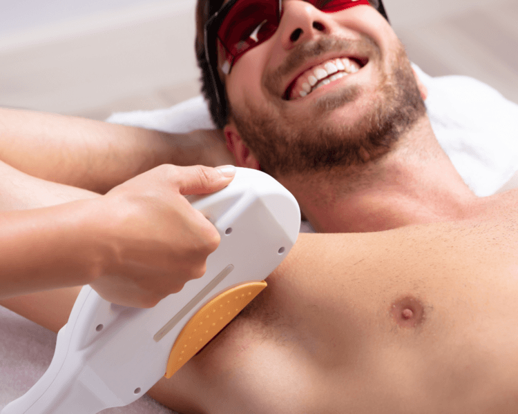 5 Zonas depilación hombre