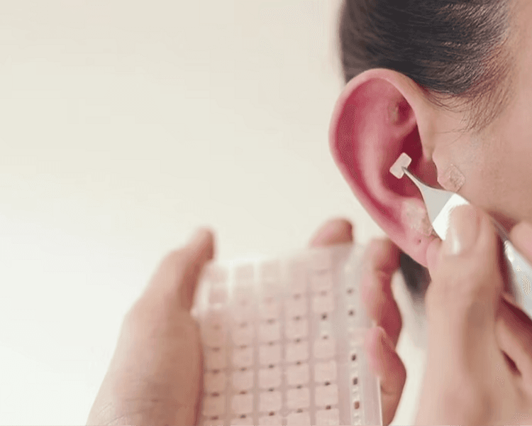 AURICULOTERAPIA - IMANES