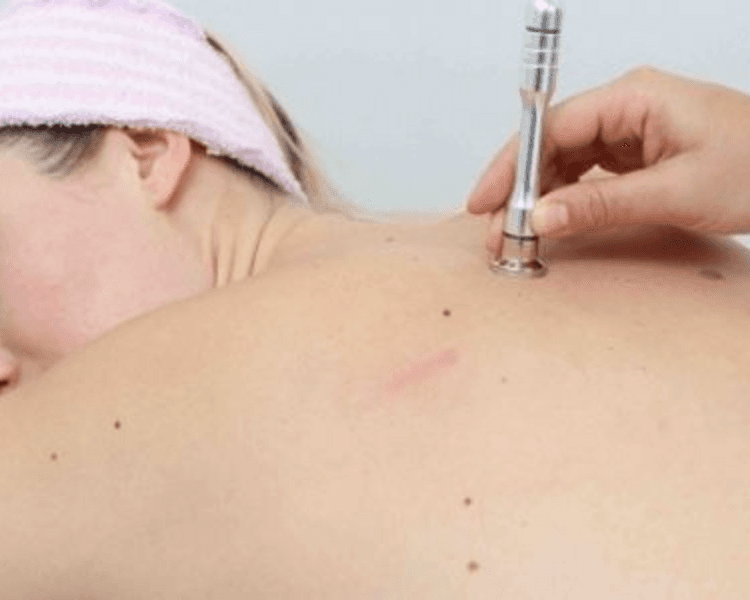 Limpieza profunda espalda