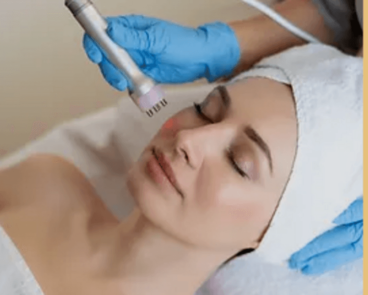 Fototerapia Anti-Acné