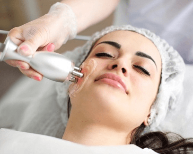 Radiofrecuencia facial ( 1 sesión)