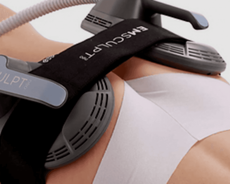 Sculpting Levantamiento de Gluteo