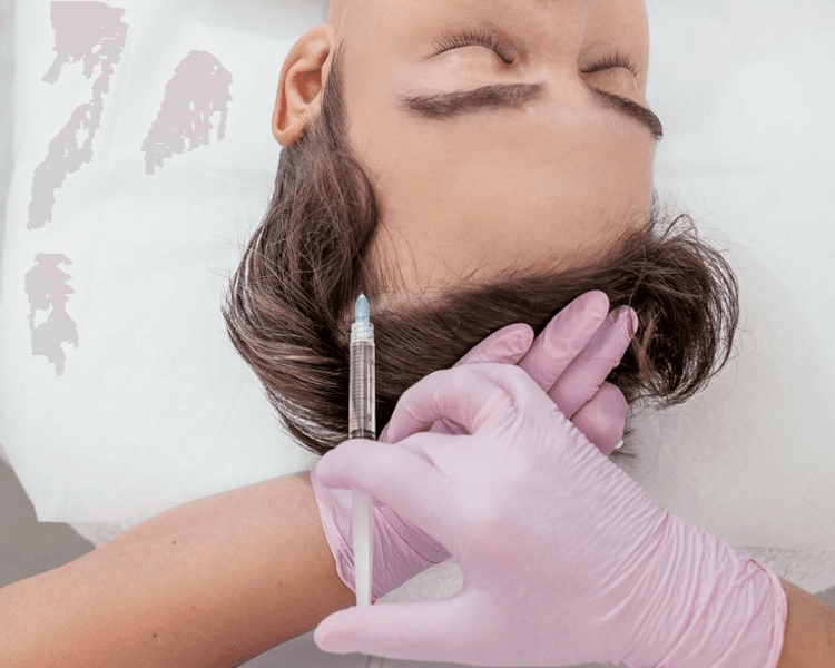 PRP Facial - Combo x3 sesiones