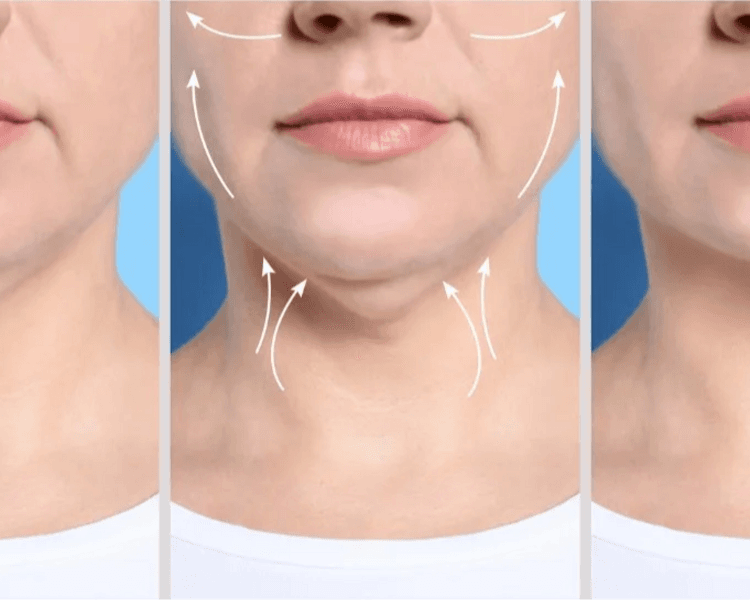 Lipopapada Enzimática