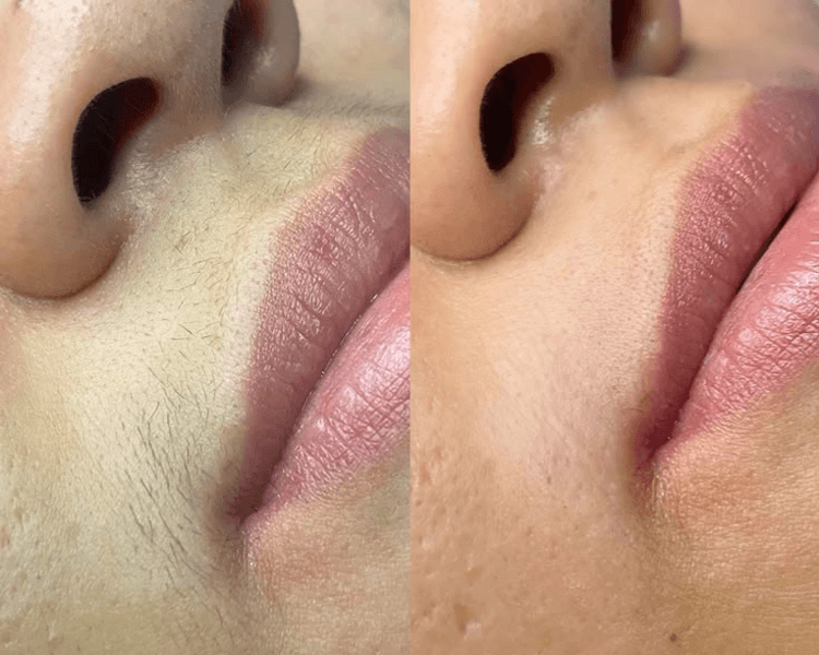 DEPILACION DE BOZO - CERA