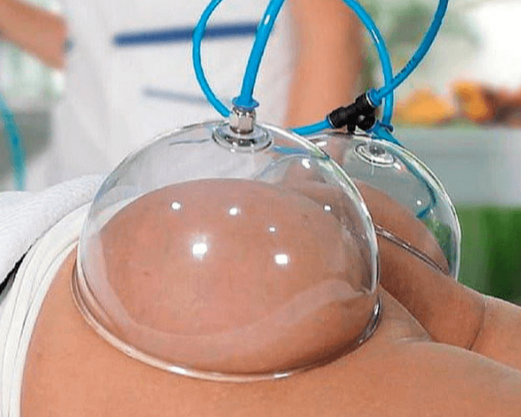 Gluteos Up por sesión